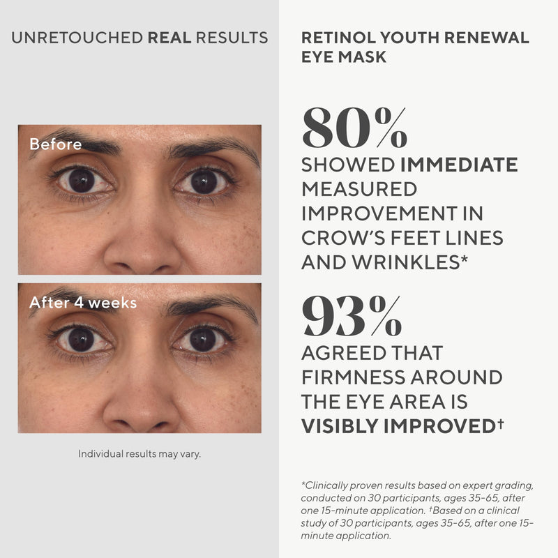 Murad Retinol Youth Renewal Eye Masks – No-Slip Full Absorption Bio-Cellulose Under Eye Patches with Retinol, Blue Agave, & Passionfruit for Lines, Wrinkles, Puffiness 5 Pair (Pack of 1)