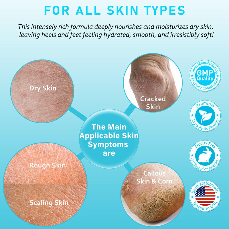 Urea Cream 40 Percent for Feet Maximum Strength w/ Vitamin E & 2% Salicylic Acid, Non-Greasy Formula Foot Cream for Summer Dry Cracked Heels - Intense Moisturizer Callus Remover for Hands, Foot, Body Camellia-Mild 5.3 Ounce (Pack of 1)