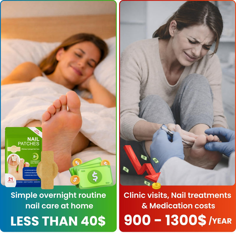 Premium Fungal Nail File Patches Toe Foot Repair Care Extra Fungus Strength 21 Pcs Nighttime Damaged Treatment Toenail ingrown Nails Strengthen 8 Hour Safe Sensitive gift for Women Men .(21 Count) 21 Count - BeesActive Australia