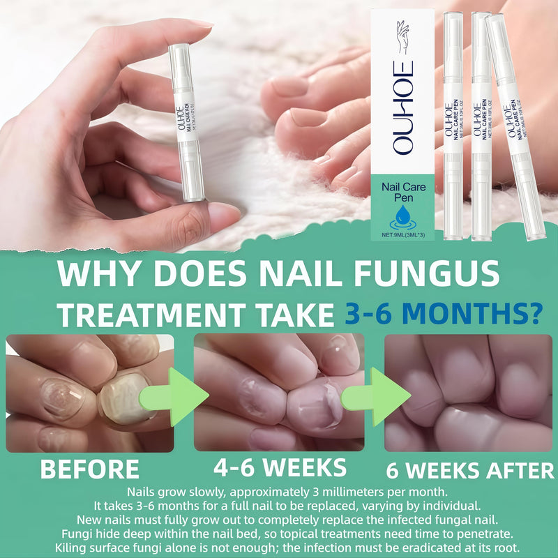 Nail Fungus Pen，Nail Growth & Repair Essence Pen, specifically designed for fungal infections on toenails and fingernails. Repairs and strengthens nails, revealing smooth and glossy nails（3pcs） 3pcs