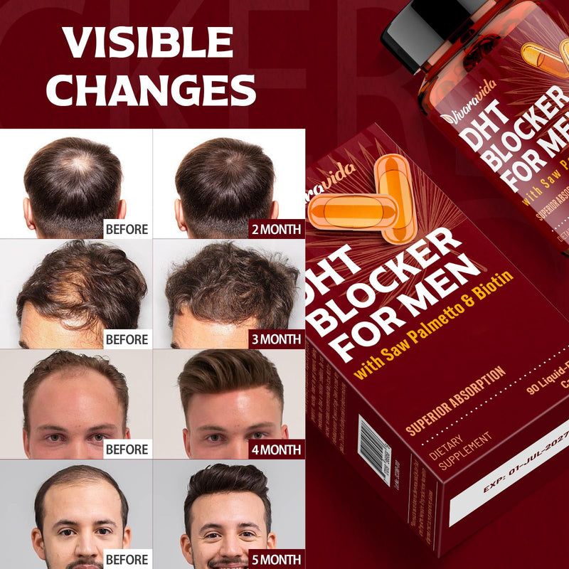 DHT Blocker for Men | Hair Growth Supplement with Saw Palmetto & Biotin - Hair Growth Vitamins - Hair Regrowth - Natural Hair Loss Supplements Liquid-Filled - Proprietary Herbal Blends (180 Capsules) 90 Count (Pack of 2)