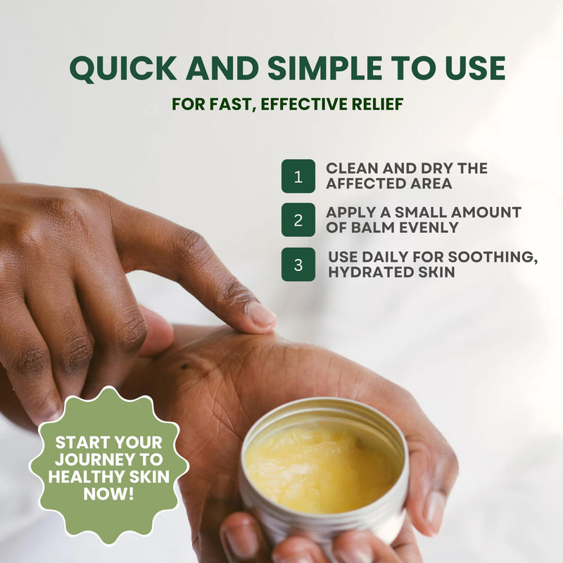 KESMEDIK Tea Tree Oil Balm for Skin, Soothes Itching, Rashes & Dry Skin, Antifungal Defense for Athlete’s Foot, Jock Itch, Chafing, Bug Bites & Eczema, Natural, Effective & Safe for All Ages 2 Ounce (Pack of 1)