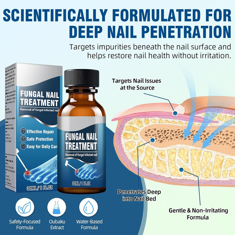 Toenail Fungus Treatment Extra Strength ‚Äì 25% Undecylenic Acid Antifungal Solution for Thick, Discolored Nails ‚Äì Podiatrist Recommended with Tea Tree, Aloe Vera & Soothing Botanicals (1 Pcs) 1 Fl Oz (Pack of 1) - BeesActive Australia