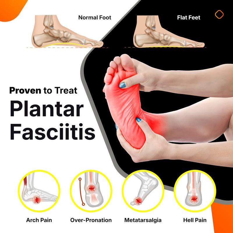 Carbon Fiber Insole with Arch Support – Plantar Fasciitis, Flat Feet, Heel Pain, Overpronation Relief, Running & Sports - Memory Foam & Breathable Fabric - Deep Heel Cup - All Day Comfort and Support Women 12.5-13.5 | Men 11-12 - BeesActive Australia