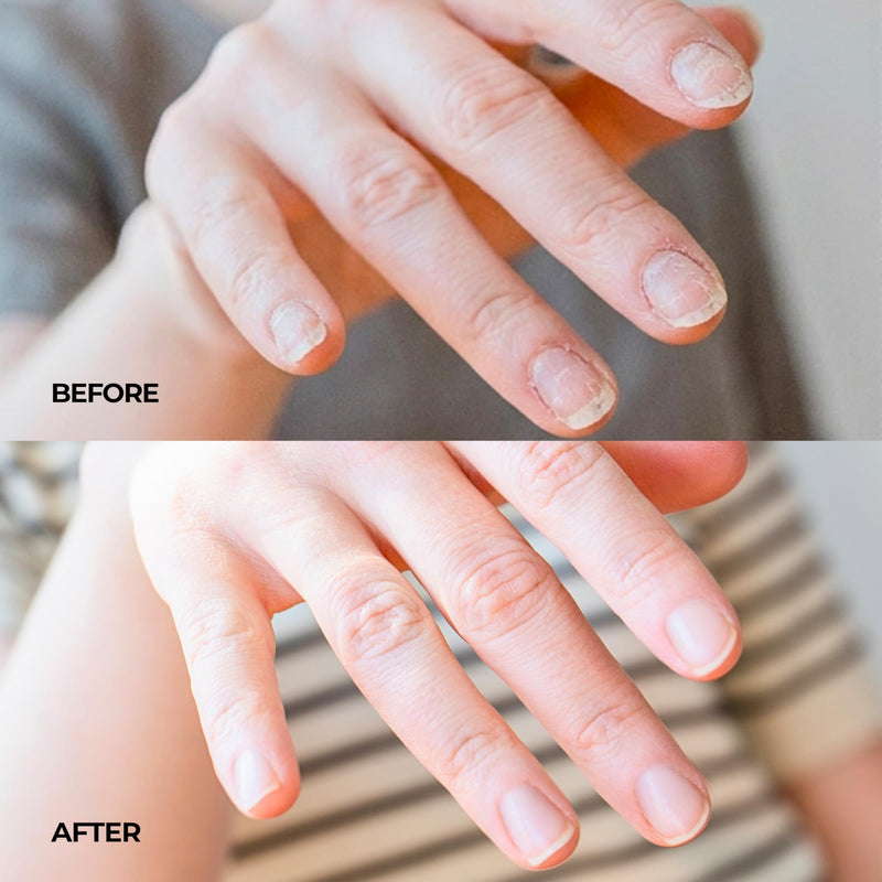 Fast-Absorbing Nail Strengthener for Weak, Thin & Post-Acrylic Damaged Nails - Perfect for Frequent Handwashing - Niacinamide, Keratin, Hyaluronic Acid & Peptides - 45 Day Supply by nakeyNails