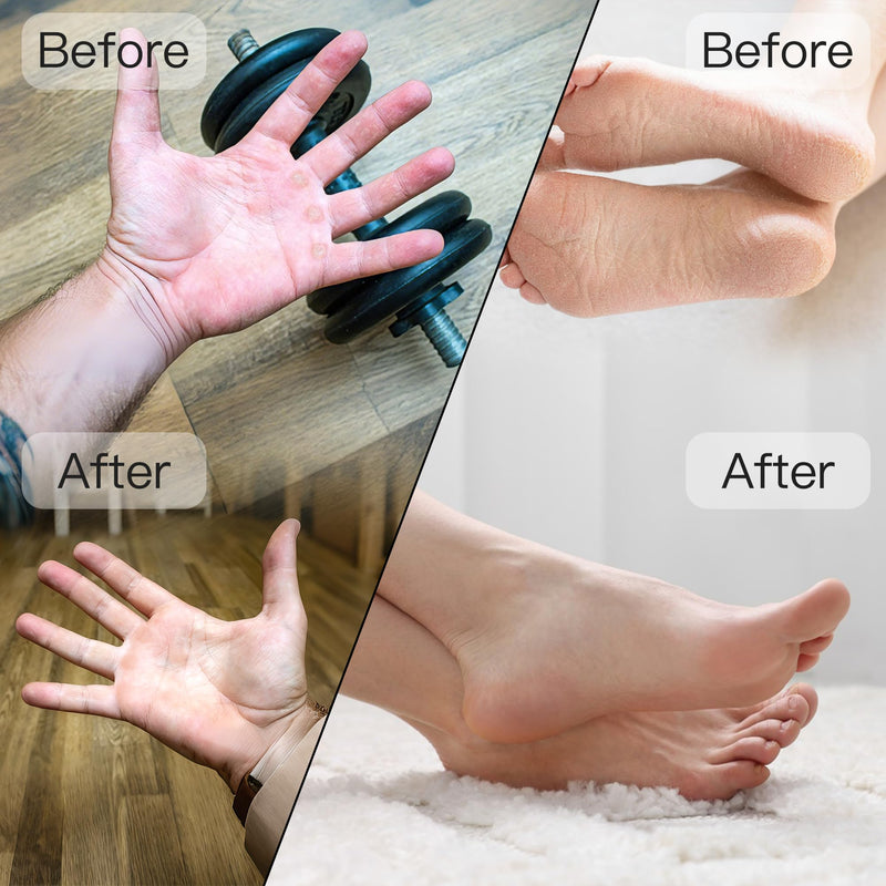 Portable Electric Hand & Foot Callus Remover with 2 Glass Grinding Heads, Rechargeable 800RPM Mini Electric Hand & Foot File for Travel Outdoors Office Gym (E9 Black Gold) - BeesActive Australia