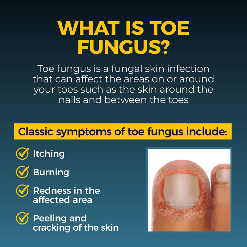 Fungi-Nail Anti-Fungal Liquid Solution, 1 Oz (Pack of 2), Kills Fungus, Athletes Foot Treatment, Toe Fungus Treatments w/Tolnaftate, Clinically Proven to Cure and Prevent Fungal Infection 1 Fl Oz (Pack of 2)