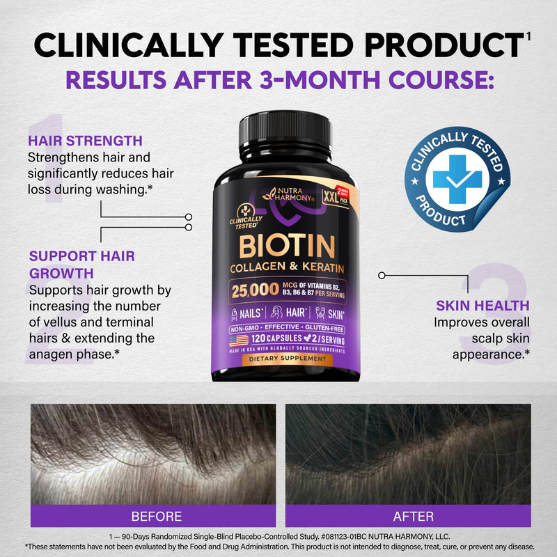 Biotin, Collagen, Hyaluronic Acid & Keratin - Hair Growth Support, 120 Caps | Hair, Skin & Nails Vitamins - Clinically Tested Supplement for Men & Women - 25000mcg Vitamins B1, B2, B3, B6 & B7 120 Count (Pack of 1)