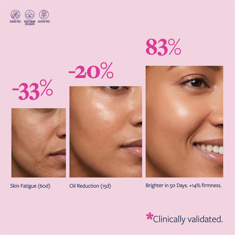 Upsa Nourished Collagen Skin Glow 30 Count – Ovoderm® Egg Membrane Complex with Vitamin C, Niacinamide & Zinc – for Elastic Skin – Sugar-Free Vegetarian Gummies – Plastic-Free Biodegradable Packaging