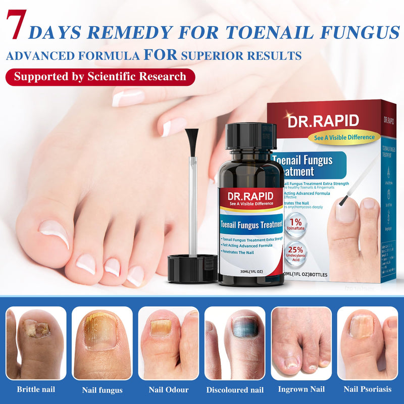 Toenail Fungus Treatment Extra Strength - Effective Antifungal Nail Repair Solution with Tea Tree Oil for Toenail & Nail Fungus, Fast Acting Treatment for Damaged Nails & Ingrown Toenail - 30ml/1fl oz 1 Fl Oz (Pack of 1) - BeesActive Australia