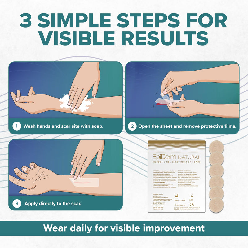Epiderm Silicone Scar Circles – Silicone Scar Patches for Face & Body – Reusable Adhesive Scar Dots for Small, Targeted Areas – Keloid & Surgical Scars (6-Pack)