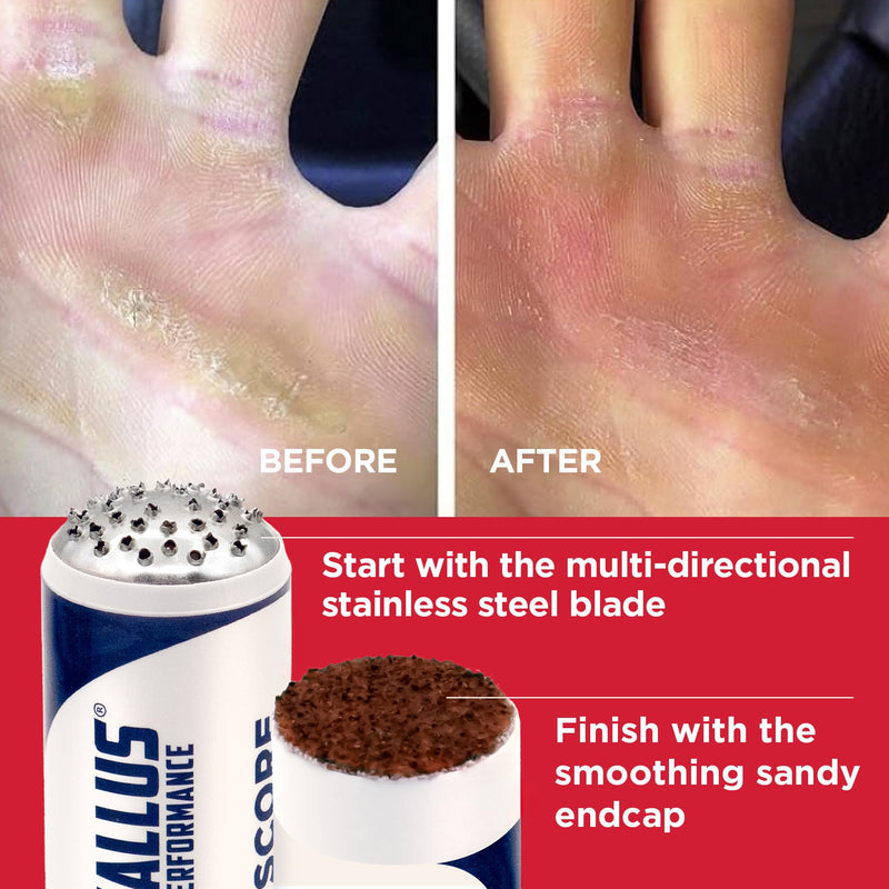 Callus Score & 2 Smoothers – Ultimate Precision Hand Callus Remover | Prevents Ripping | Smoother for Athletes, Weightlifters & Gym Enthusiasts | Solution for Dry, Rough Hands & Fingers Score Bundle with Additional Smoothing caps - BeesActive Australia