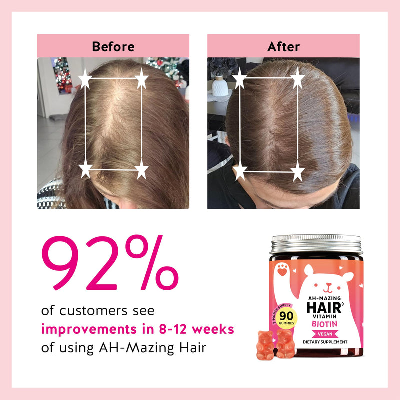 Bears with Benefits Biotin 5,000 mcg Hair Growth Gummies | Complete beauty formula with Vitamins C & E, Zinc and Iodine to support healthy hair, glowing skin and stronger nails. 60 Count (Pack of 1)
