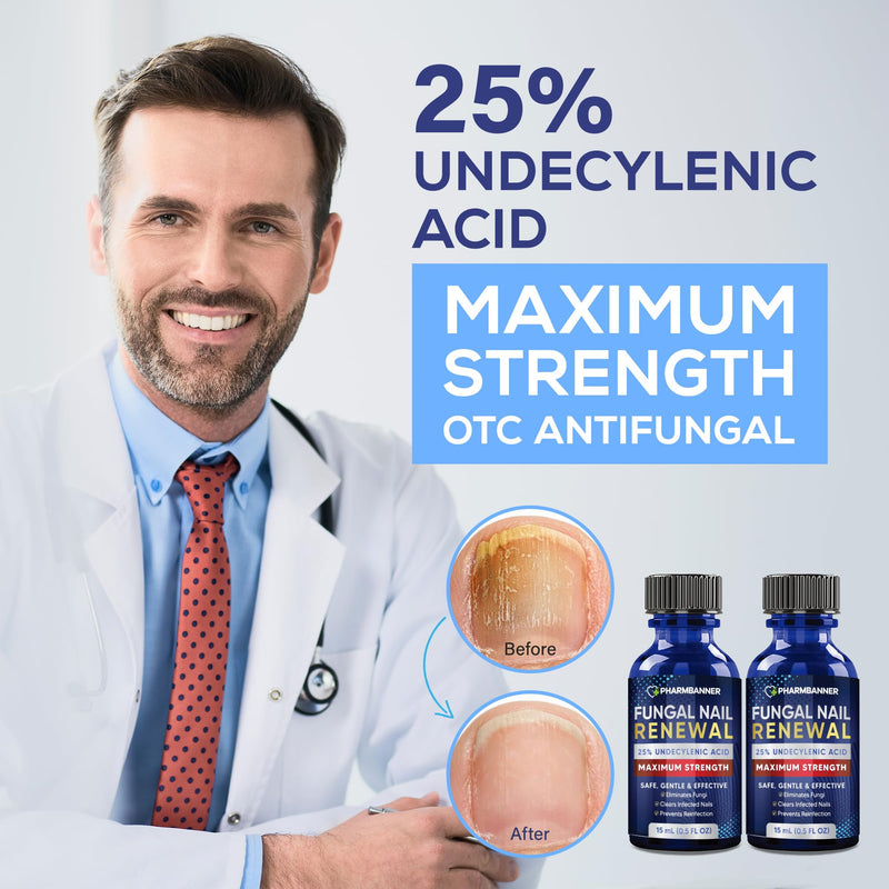 Toenail Fungus Treatment Extra Strength: 25% Undecylenic Acid Toe & Fingernail Fungus Renewal - Nail Fungus Treatment Kit with Brush & File - For Ingrown Nails & Discoloration 1 Fl Oz (Pack of 1)