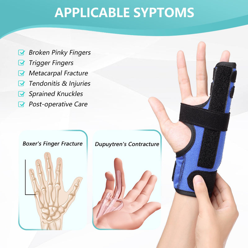 Boxer Fracture Splint, Pinky Finger Splint, Adjustable Two Finger Brace for 4th or 5th Finger, Metacarpal Splint Hand Brace for Arthritis Fracture Broken Mallet Dislocated Trigger Finger(S/M) S/M