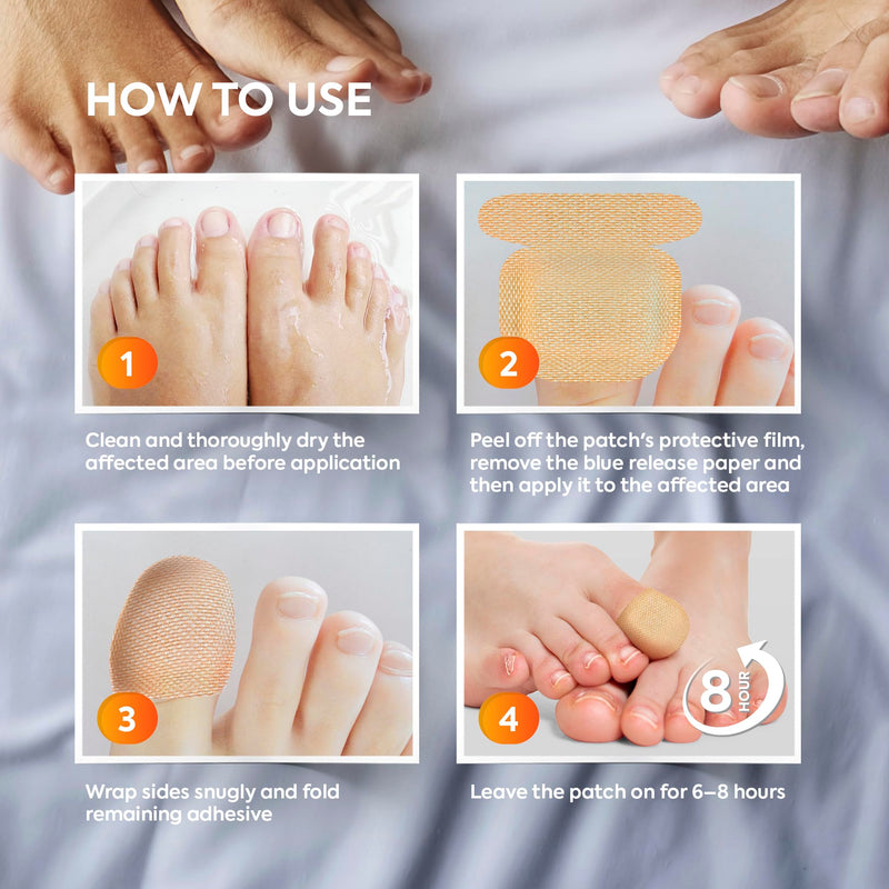 Natural Vine Fungal Nail Patches: Max Strength Formula for Toenail and Fingernails - 8-Hour Nighttime Renewal with 1% Tolnaftate - Toenail Fungus Treatment Extra Strength 32 Patches 32 Count (Pack of 1)