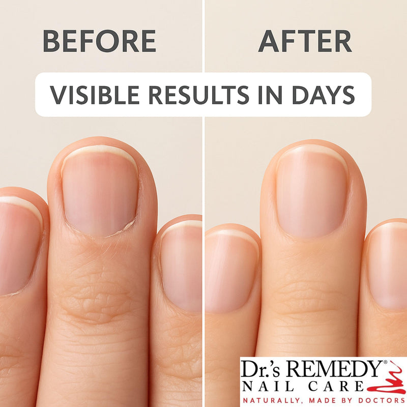 Dr.'s Remedy Therapeutic Caress Cuticle Oil, Nourishing Treatment for All Nail Types, 0.507 Fl Oz (Pack of 1) - BeesActive Australia