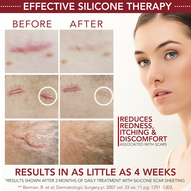 HealFast Silicone Scar Gel & Cream for Surgical Scars - Medical Grade Scar Treatment & Removal for Keloid, Acne, Burns, C Section, Stretch Marks - Physician Formulated Advanced Silicone Gel for Scars - BeesActive Australia