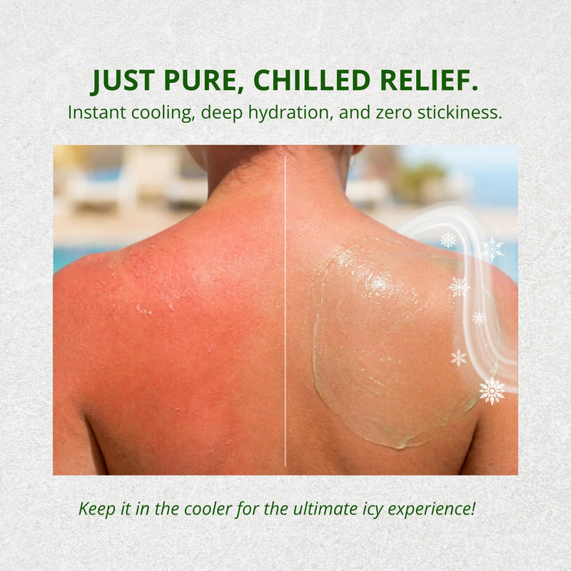 Rubber Ducky Cooler Gel - Sunburn Relief |Soothing Aloe Vera Gel | Fast Absorbing Aloe Gel With Vitamin E & Tea Tree Oil | Vegan | After Sun Care | 10z 10 Ounce (Pack of 1)