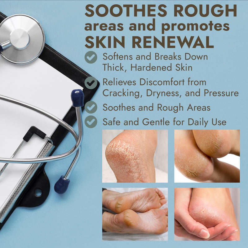 Callus Remover for Feet | Extra Strength Callus Remover Gel for Feet with Tea Tree Oil | Professional-Grade Pedicure Treatment | 50 Applications per Bottle, Includes 3 Pumice Stones | 14 fl oz - BeesActive Australia