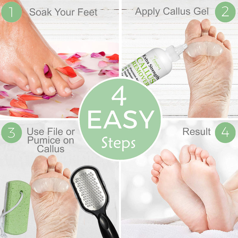 Dr. Entre's Callus Remover Gel Kit for Feet: Foot File, Pumice Stone, 5 Glove Pairs for Gel Application, Spa Kit, Foot Care, Pedicure Tools, Scrubber, 8oz Callus Remover Kit - BeesActive Australia