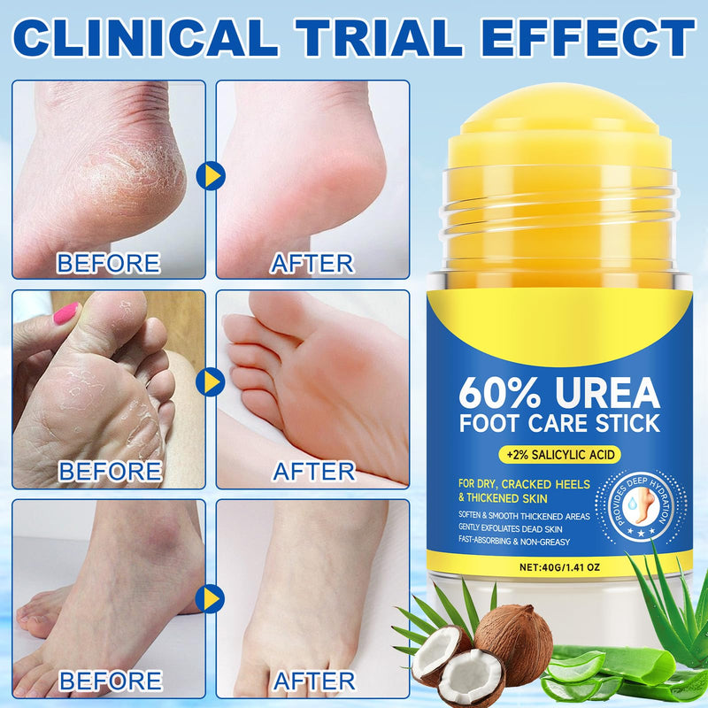 60% Urea Foot Cream Stick with 2% Salicylic Acid, Urea Foot Care Stick & Cream - Moisturizer for Dry, Cracked Skin on Feet, Knees, Elbows & Hands - Hydrates & Repairs Rough Skin 2Pack 1.41 Fl Oz (Pack of 2)