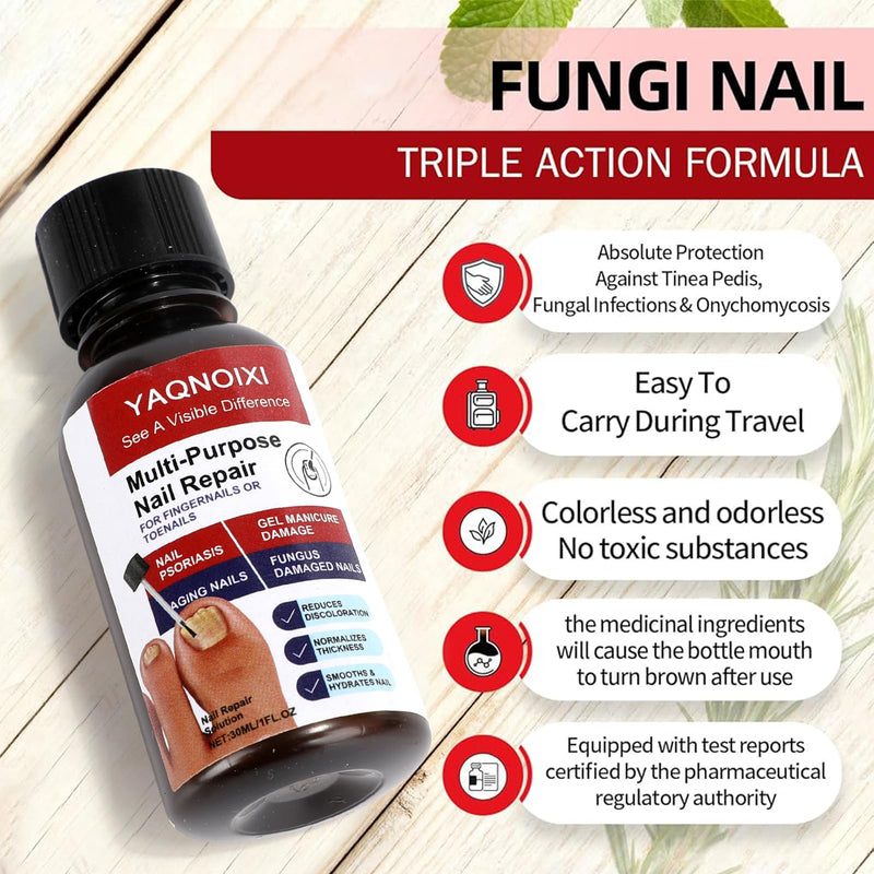 Toenail Fungus Treatment - Fast Acting For Thick, Discolored, Broken & Damaged Toe & Finger Nail, Treats Damaged Nails and Ingrown Toenails - 30ml/1oz (1pcs) 1pcs