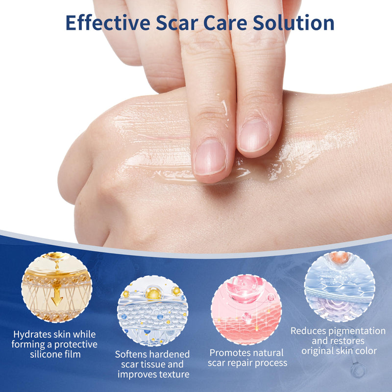 Silicone Scar Gel, Advanced Medical Grade Scar Silicone Cream for Old & New Scars, Surgical Scars, Acne, Burn, Keloids & Stretch Marks 30g - BeesActive Australia