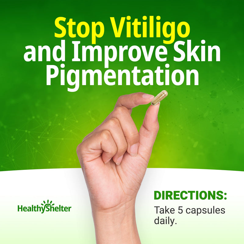 Say Goodbye to Vitiligo and White Spots On Skin with Effective Skin Pigmentation Treatment Seronex. Use with Repigmentation Creams. Includes These Vitiligo Vitamins: D and B6.