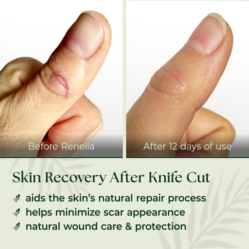 Natural Wound Care & Burn Gel – First Aid Gel for Cuts, Scrapes & Burns – Advanced Skin Repair Ointment & Cream Alternative– Stable at Room Temperature – Soothing Film-Forming Barrier – Fragrance-Free