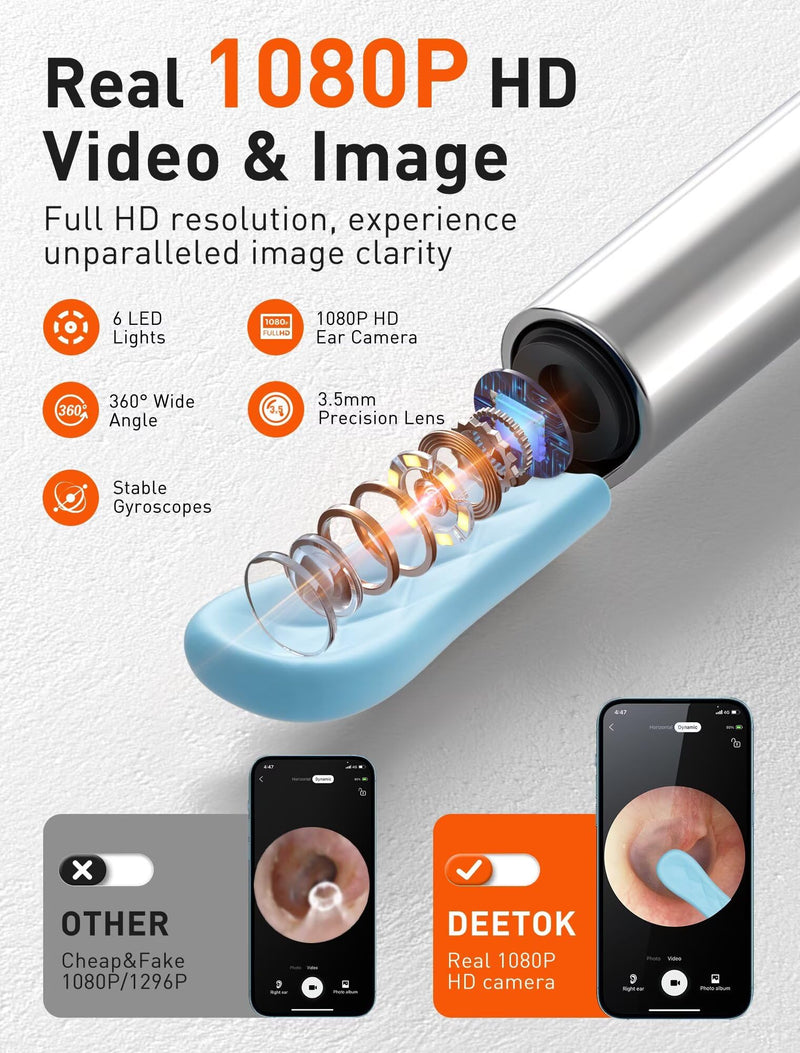 Ear Wax Removal Tool Camera - Ear Cleaner with 1080P HD Camera, FSA HSA Store Eligible, Otoscope with Light, Earwax Removal Kit with 50 Replacement Tips for iPhone, iPad, Android Phones (Black) Black - BeesActive Australia
