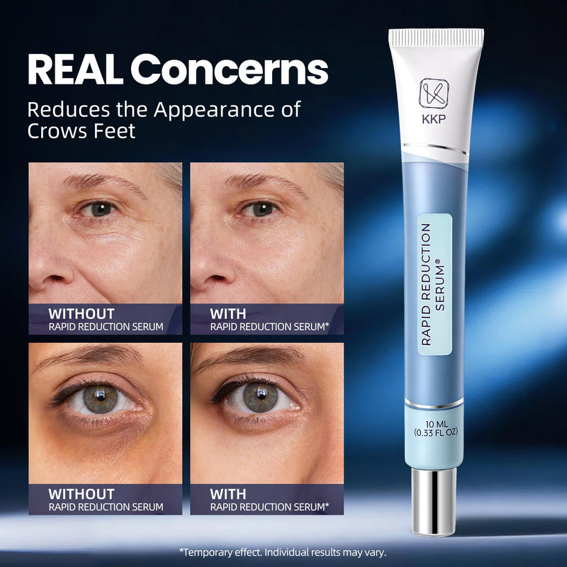KKP Rapid Reduction Eye Serum & Face Lift Cream - Visibly Reduces Under-Eye Bags, Wrinkles, Dark Circles, Fine Lines & Crow's Feet Instantly, Anti Aging Wrinkle Remover for Face 3PACK - BeesActive Australia