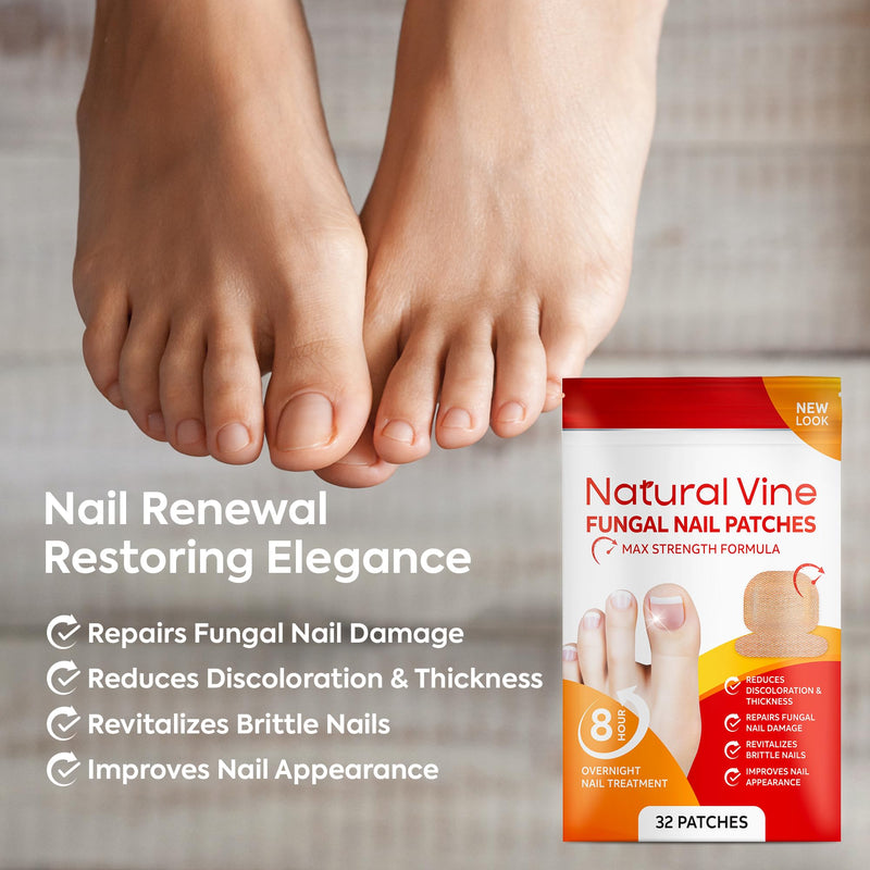 Natural Vine Fungal Nail Patches: Max Strength Formula for Toenail and Fingernails - 8-Hour Nighttime Renewal with 1% Tolnaftate - Toenail Fungus Treatment Extra Strength 32 Patches 32 Count (Pack of 1)