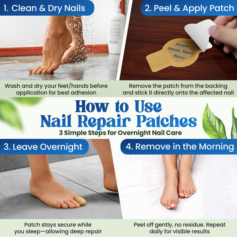 Premium Fungal Nail File Patches Toe Foot Repair Care Extra Fungus Strength 21 Pcs Nighttime Damaged Treatment Toenail ingrown Nails Strengthen 8 Hour Safe Sensitive gift for Women Men .(21 Count) 21 Count - BeesActive Australia