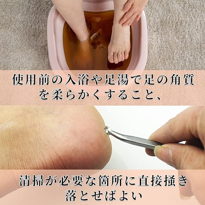 Doyime Exfoliating Remover, Exfoliating Fish, Exfoliating Files, Double-sided Foot Files, Foot Files, For Foot Files, For Dry And Dry Feet, Silver -  Australia