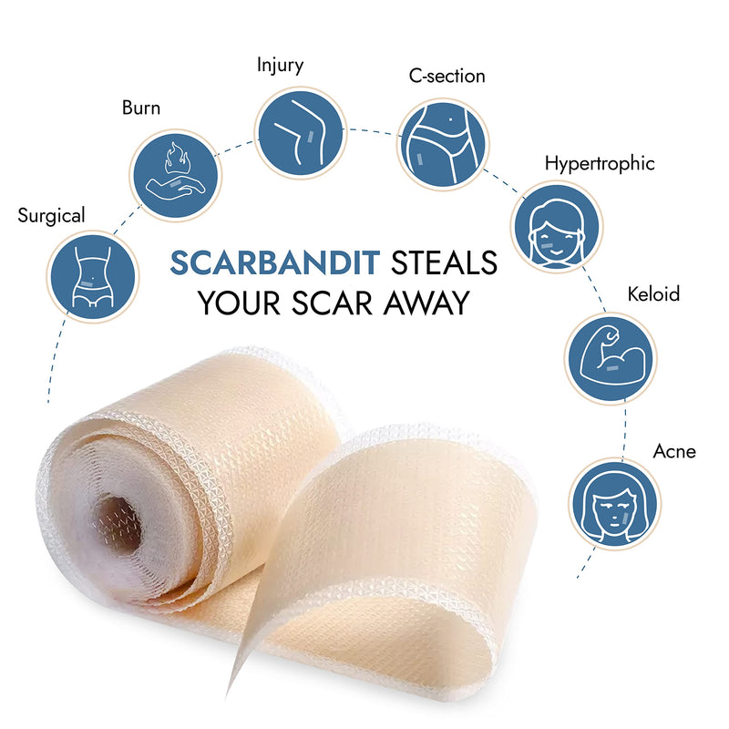 Scarbandit Silicone Scar Tape – Reusable Scar Sheets for Surgical Scars, Keloid Bump Removal, Burn, Acne Treatment, Stretch Mark Removal & c-Section – Waterproof & Breathable 118inch Scar Strips 1.57 x 118 Inch - BeesActive Australia