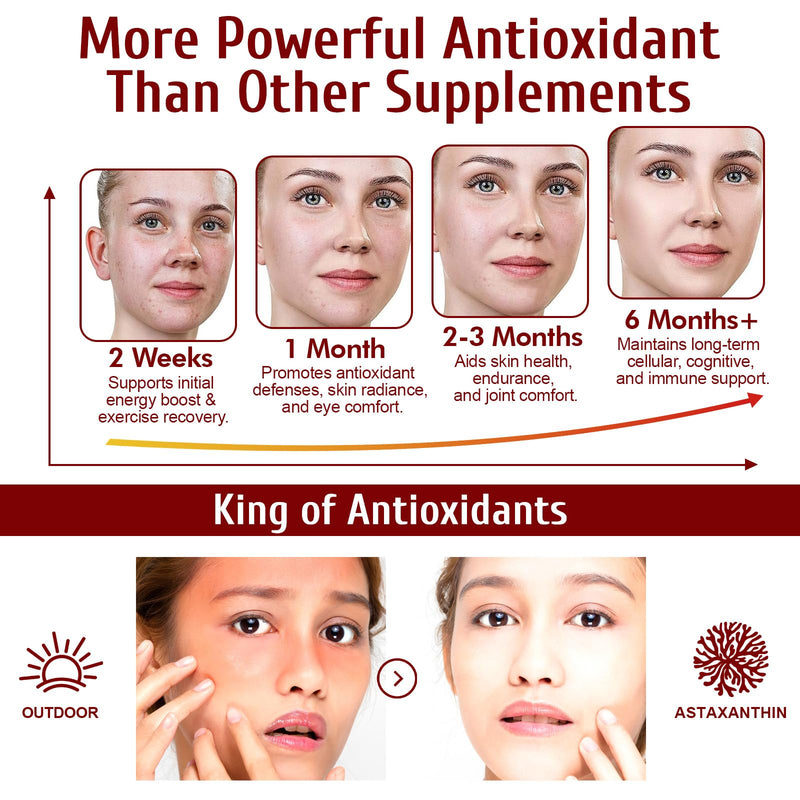 Astaxanthin Supplements 12mg 120 Softgels,Premium Astaxanthin Antioxidant Supplements,Triple Strength Skin Vitamins with Antioxidant Activity,Supports Eye, Joint, Brain, Heart & Immune System (1) 1 - BeesActive Australia