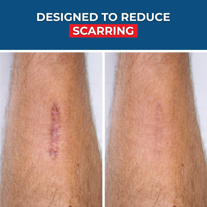 SilverSeal Hydrogel Burn & Wound Dressing Kit with X-Static Silver - FDA Cleared Care for Burns, Cuts & Wounds ‚Äì Soothing Moisture, Relief & Protection - 4 (2‚Äùx3‚Äù) Hydrogels + 4 (3‚Äùx5‚Äù) Adhesive Pads - BeesActive Australia