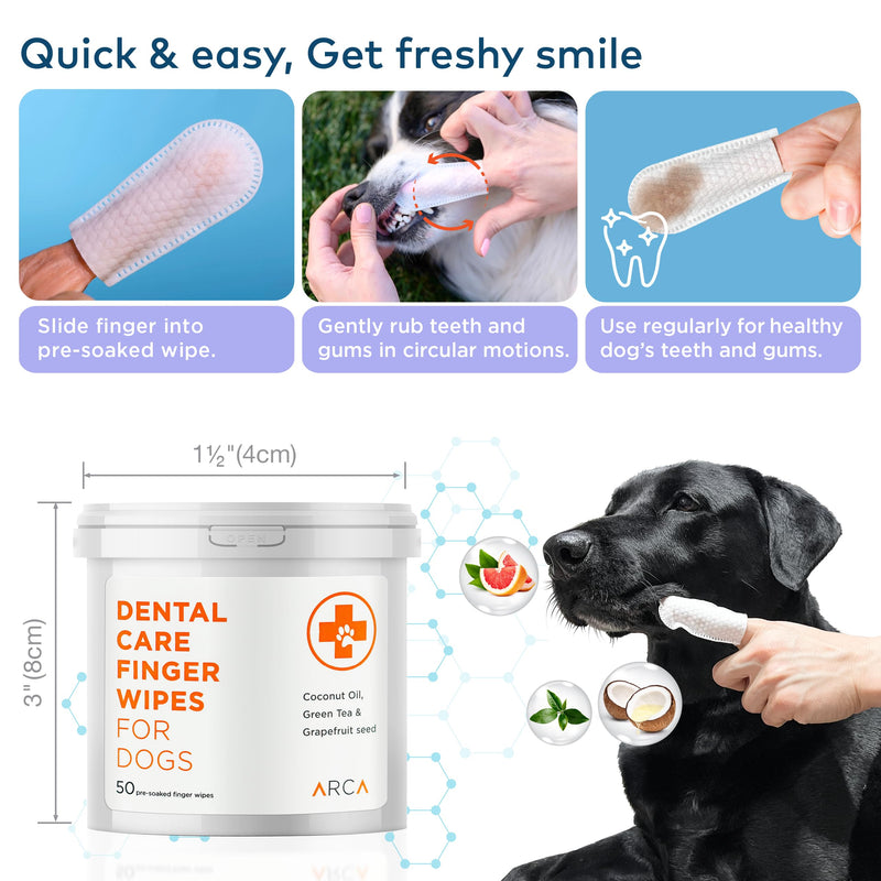 Dental Finger Wipes for Dogs - 100 Wipes - Vet Formulated Dog Dental Teeth Cleaning Wipes for Dogs - Pre-Soaked Oral Cleaning Pads- Reduces Plaque, Tartar & Dog Breath Freshener 100 Finger Wipes - PawsPlanet Australia