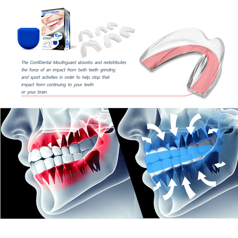 The ConfiDental - Pack of 6 Moldable Mouth Guard for Teeth Grinding Clenching Bruxism, Sport Athletic, Whitening Tray Old Black