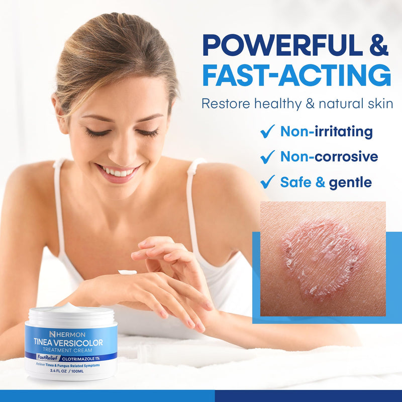 Hermon Tinea Versicolor Treatment Cream:Multi-Functional Clinically Proven 1% Clotrimazole Cream for Athlete's Foot, Tinea Versicolor, Jock Itch, Ringworm 3.4 Ounce (pack of 1) - BeesActive Australia