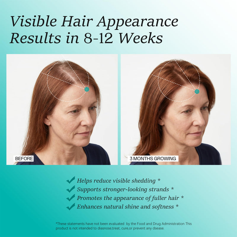 Hair Growth Supplements for Women, Ages 30 and Up - Clinically Tested for Visibly Thicker Hair with Biotin 10,000mcg, Vitamins, Keratin, Collagen, Saw Palmetto, Supports Scalp, Skin & Nails, 120 ct 120 Count (Pack of 1)