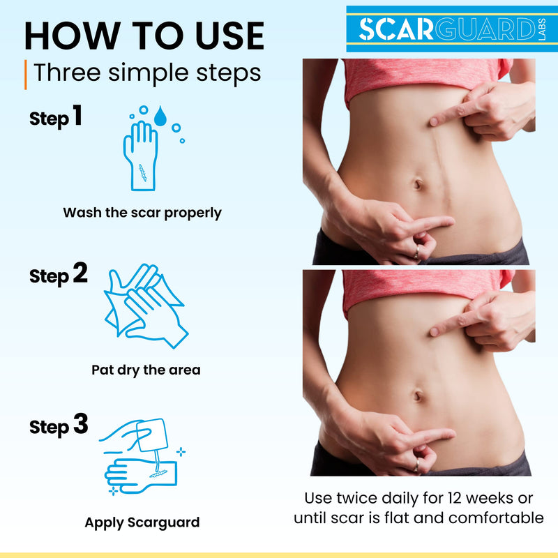 Scarguard - Invisible Brush-On Silicone Sheet with Vitamin E - Scar Removal for Keloids, Burn Scars, Surgery Scars, Stitches, Cuts - No Ugly Scar Sheets, Cream or Messy Scar Gel Needed - BeesActive Australia