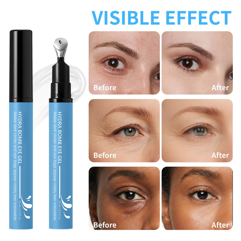 Hydrating Cooling Eye Gel - Under Eye Gel Cream with Hyaluronic Acid & Caffeine & Vitamin C - Under Eye Treatment Serum Target Dark Circles and Puffiness - Skin Care for Eyes, 0.5 fl oz