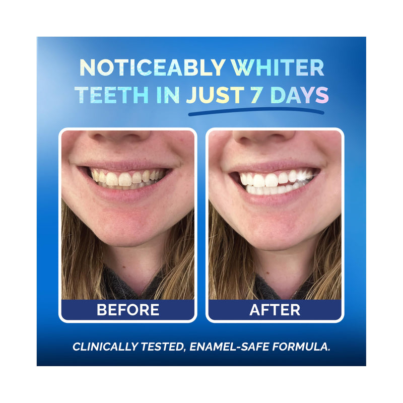 Whitening Strips for Sensitive Teeth ‚Äì Enamel Safe, Peroxide-Free Coconut Teeth Whitening Strips with Natural Enzymes ‚Äì Gentle White Stips for Sensitive Gums (14 Count, Mint) - BeesActive Australia