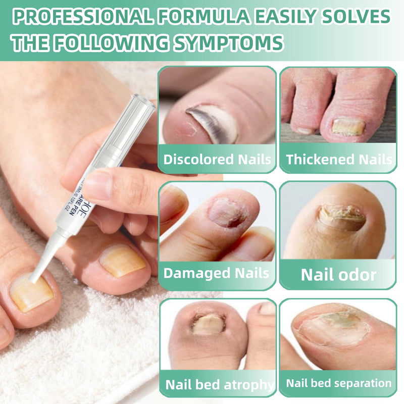 Nail Fungus Pen，Nail Growth & Repair Essence Pen, specifically designed for fungal infections on toenails and fingernails. Repairs and strengthens nails, revealing smooth and glossy nails（3pcs） 3pcs