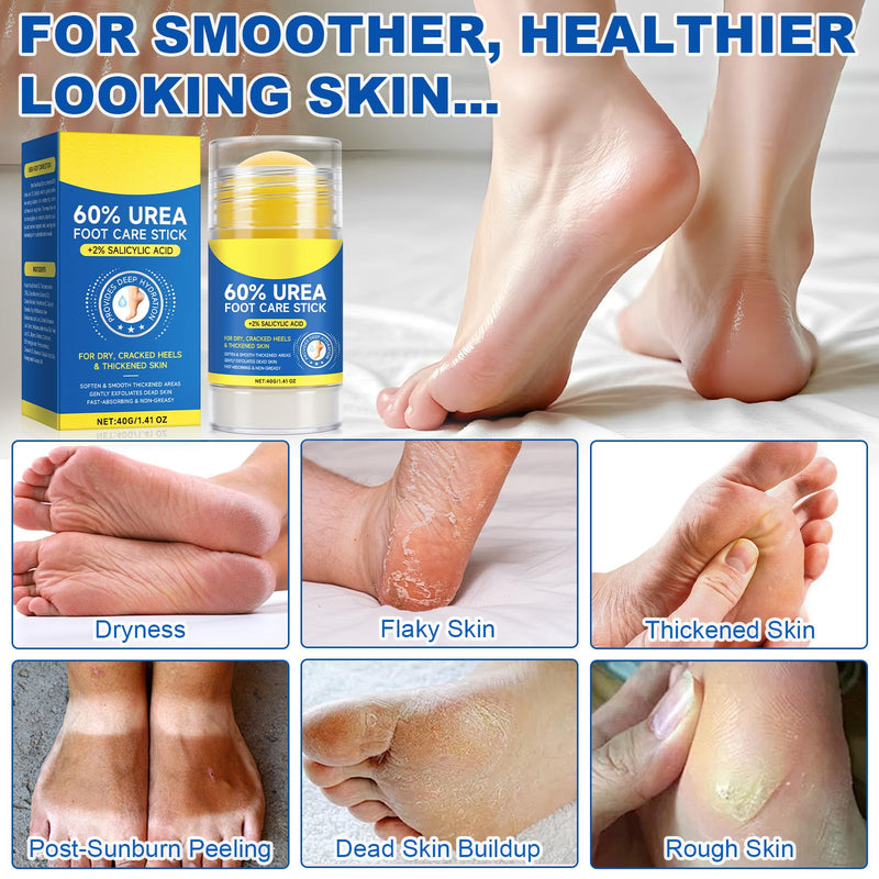 60% Urea Foot Cream for Cracked Heels, Maximum Strength 2% Salicylic Acid, Fast Absorbing, Intensive Moisturizing Foot Repair for Dry, Rough Skin & Callus Remover for Feet, 2 Sticks 1.41 Ounce (Pack of 2)