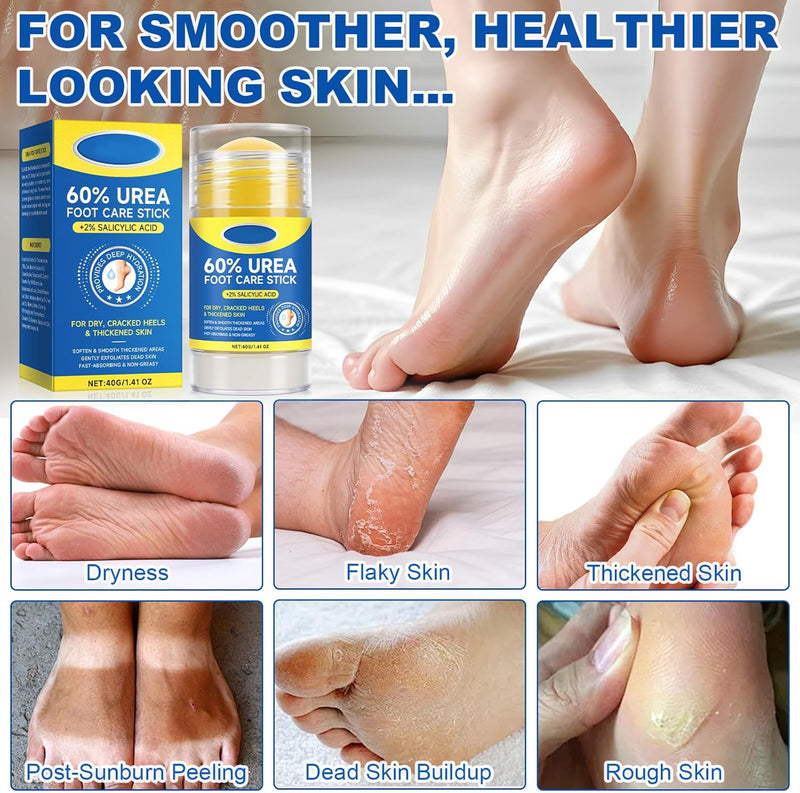 60% Urea with 2% Salicylic Acid Foot Care Stick, Maximum Strength Urea Foot Cream Callus Remover for Dry Cracked Heels, Hands, Knees, Exfoliating Moisturizer, Dead Skin Remover Foot Balm 1.41oz 1.41 Fl Oz (Pack of 1)