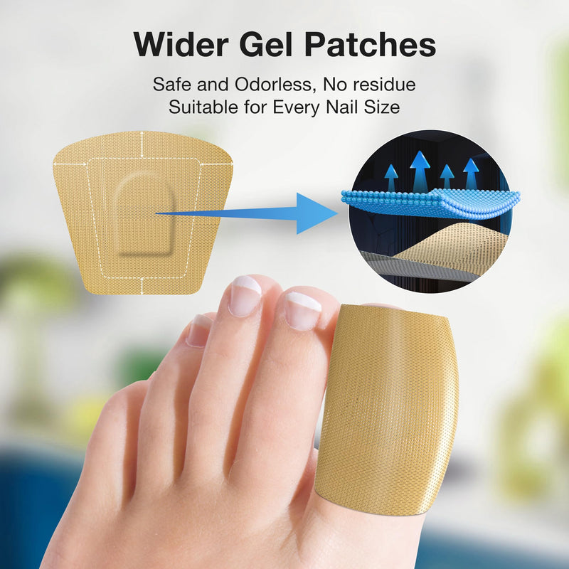 Toenail Fungus Treatment Extra Strength - 30mL Toenail Fungus Treatments Liquid & 20 Fungal Nail Patches Nail Repair for Damaged Nails, for Fungi Nails, Athletes Foot - Nail Care Kit 1 Count (Pack of 2)
