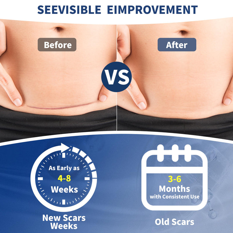 Silicone Scar Gel, Advanced Medical Grade Scar Silicone Cream for Old & New Scars, Surgical Scars, Acne, Burn, Keloids & Stretch Marks 30g - BeesActive Australia